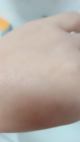 蘭亭玻尿酸原液好用嗎安全嗎，真實(shí)使用體驗(yàn)(補(bǔ)水/保濕/安全)